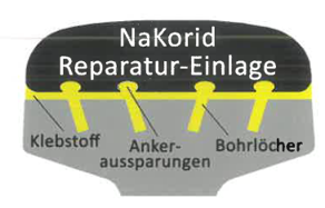NaKorid 5
